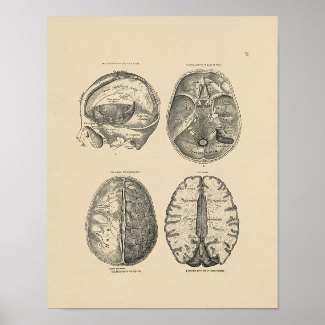 Vintage Brain Skull Anatomy 1880 Print (Front)