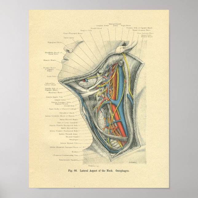 Vintage Frohse Anatomical Lateral Neck Poster (Front)