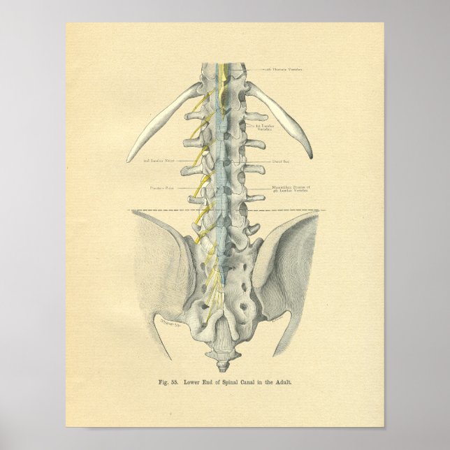 Vintage Frohse Anatomical Lumbar Spine Poster (Front)