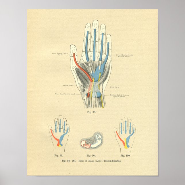 Vintage Frohse Anatomy of Hand & Tendons Poster (Front)