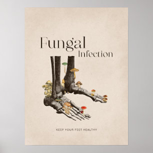 Vintage Fungal Infection Foot Care Poster