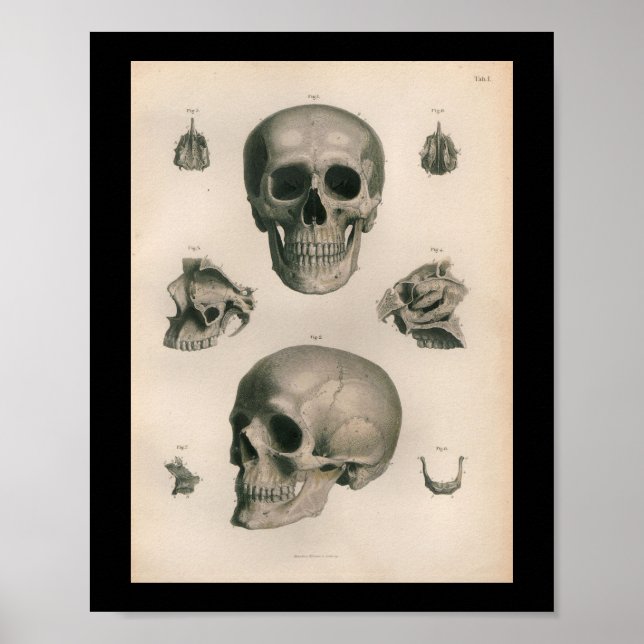 Vintage Human Anatomy Print Skull Bones (Front)