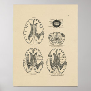 Vintage Human Brain Anatomy 1880 Print