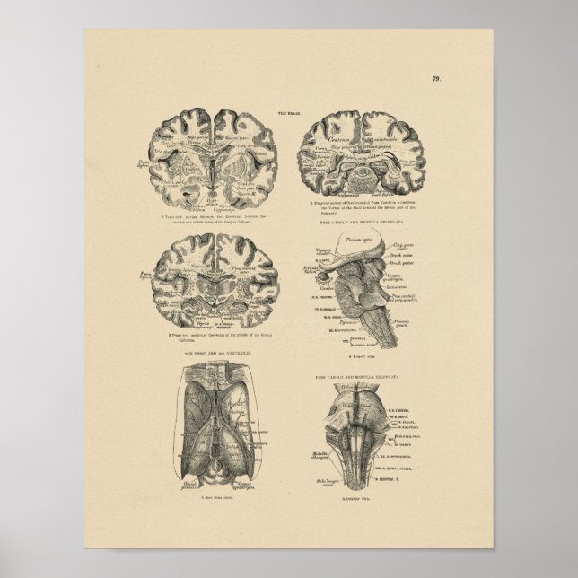 Vintage Human Brain Anatomy 1880 Print (Front)