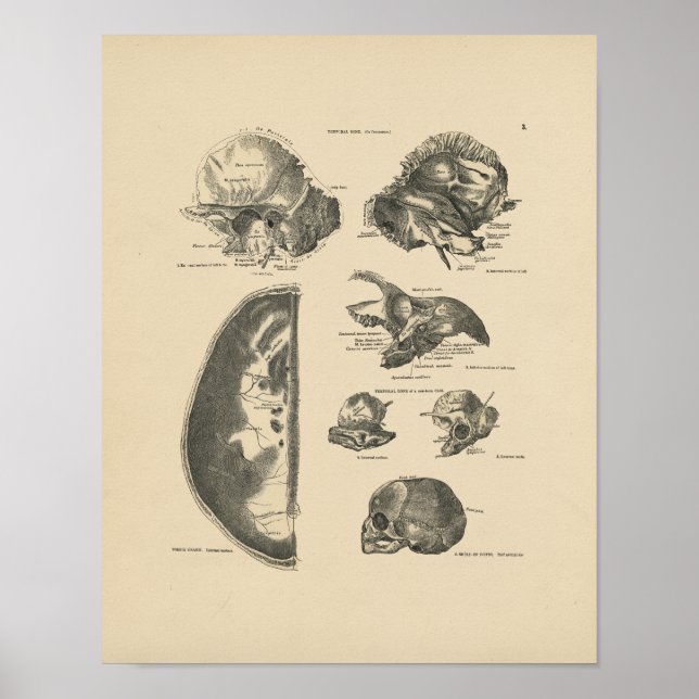 Vintage Human Skull Bones 1880 Print (Front)