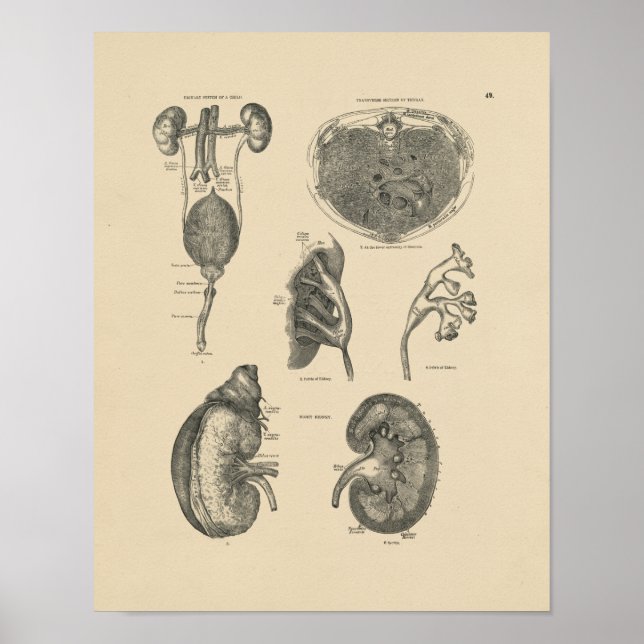Vintage Kidney Bladder Anatomy 1880 Print (Front)