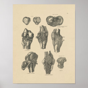 Vintage Knee Joint Anatomy 1880 Print