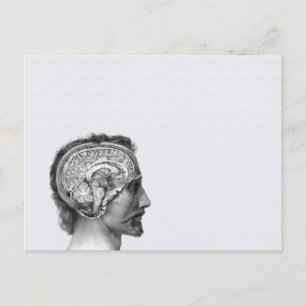 Vintage Medical Illustration Postcard