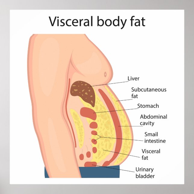 Visceral body fat poster (Front)