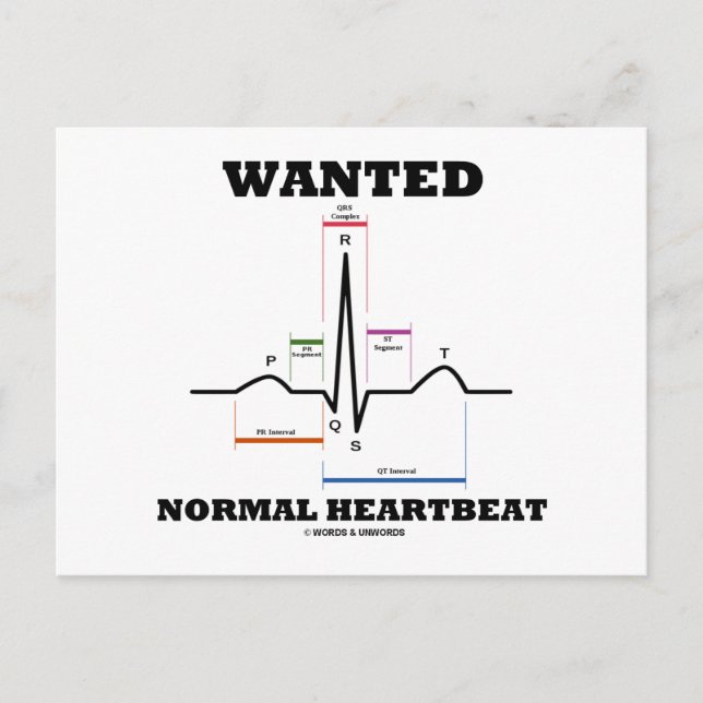 Wanted Normal Heartbeat (Electrocardiogram) Postcard (Front)