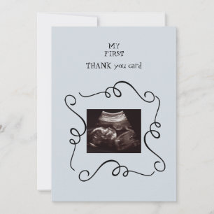 Whimsical Ultrasound Thank You Baby Point of View Card
