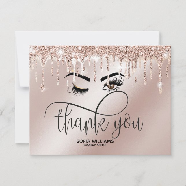 Wink Beautiful Brown Eye with Gold Crown Aftercare Thank You Card (Front)