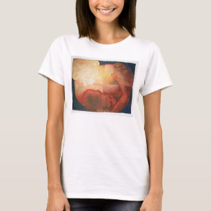 Wound 2004 T-Shirt