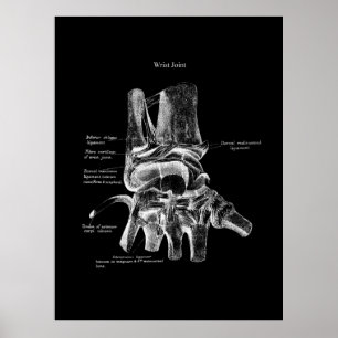 Wrist Anatomy Medical Poster Orthopaedic Decor