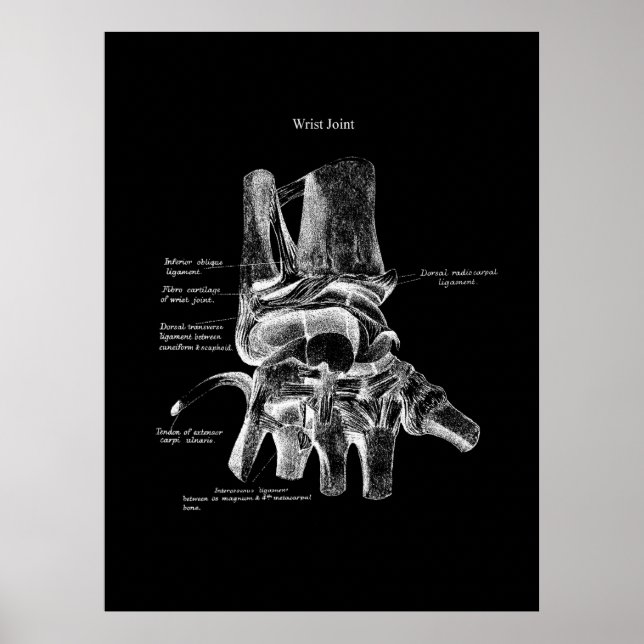 Wrist Anatomy Medical Poster Orthopaedic Decor (Front)