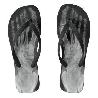 X ray anatomy skeleton feet cool flip plops flops