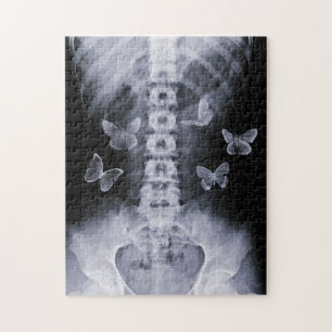 X-Ray Conceptual Butterflies Puzzle