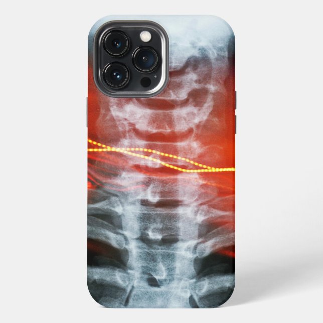 X-Ray Digital Artwork Phone Case (Back)