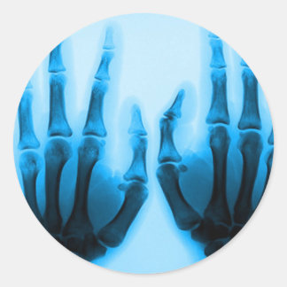 X Ray Stickers | Zazzle.co.uk