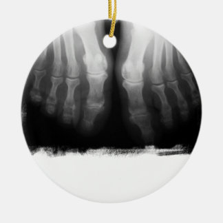 X-Ray Feet Human Skeleton Bones Black & White Ceramic Tree Decoration