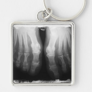 X-Ray Feet Human Skeleton Bones Black & White Key Ring