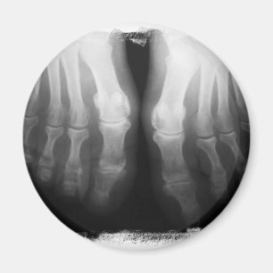 X-Ray Feet Human Skeleton Bones Black & White Magnet