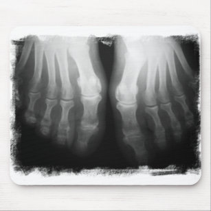 X-Ray Feet Human Skeleton Bones Black & White Mouse Mat