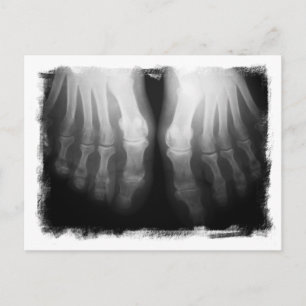 X-Ray Feet Human Skeleton Bones Black & White Postcard