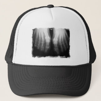 X-Ray Feet Human Skeleton Bones Black & White Trucker Hat