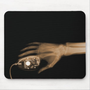 X-Ray Hand & Computer Mouse Mat