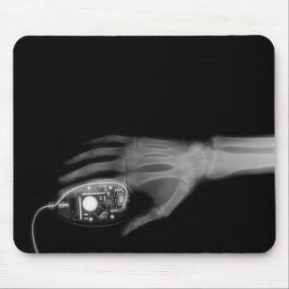 X-Ray Hand & Computer Mouse Mouse Mat