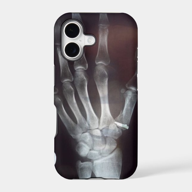 X Ray Hand Phone Case (Back)