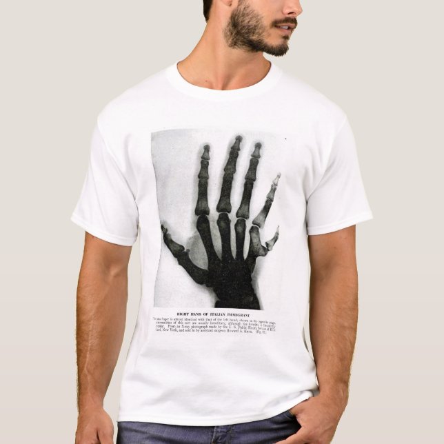 X-Ray Hand with Extra Finger Shirt (Front)