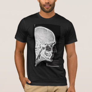X-Ray Head T-Shirt