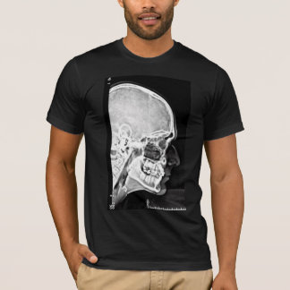 X-Ray Head T-Shirt
