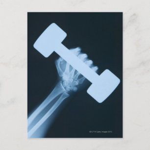 X-ray image of human hand with weight, close-up postcard