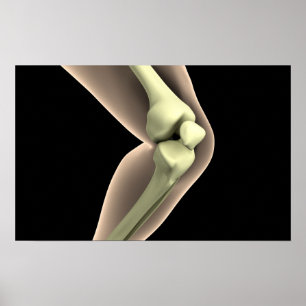 X-Ray Image Of Knee 2 Poster