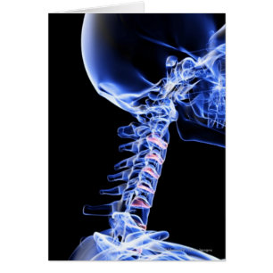 X-ray image of the bones of the neck