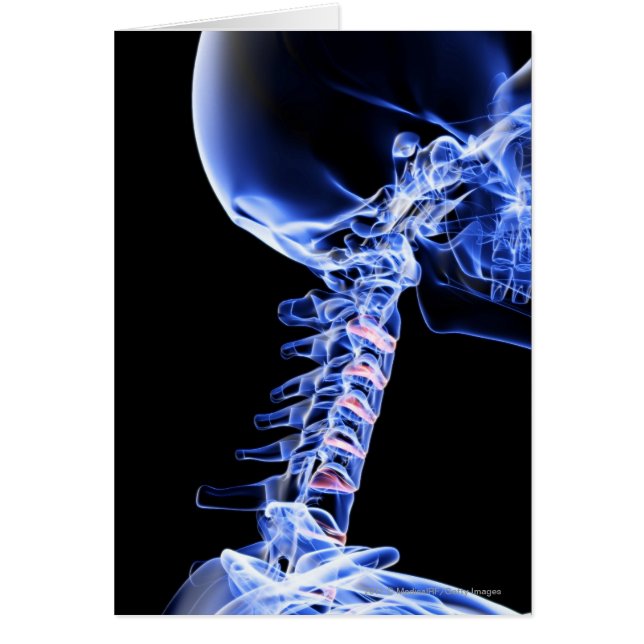 X-ray image of the bones of the neck (Front)