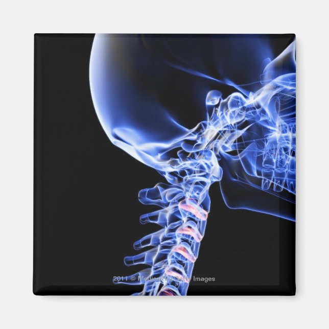 X-ray image of the bones of the neck magnet (Front)