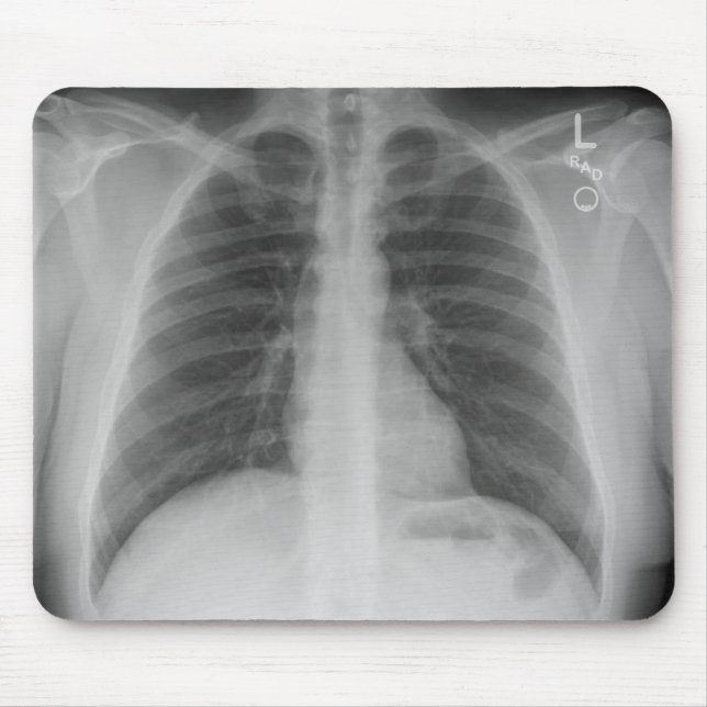 X-Ray Mousepad (Front)