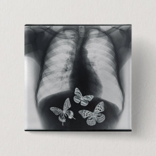 X-ray of butterflies in the stomach 15 cm square badge