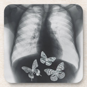 X-ray of butterflies in the stomach coaster