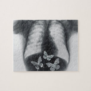 X-ray of butterflies in the stomach jigsaw puzzle