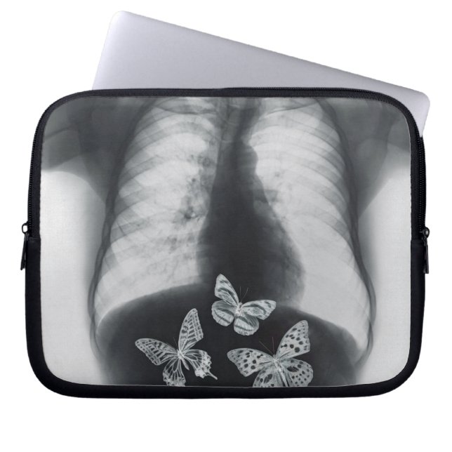 X-ray of butterflies in the stomach laptop sleeve (Front)