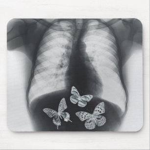 X-ray of butterflies in the stomach mouse mat