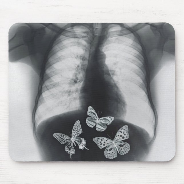 X-ray of butterflies in the stomach mouse mat (Front)