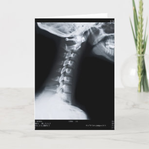 X ray of neck vertebrae including lower jaw card