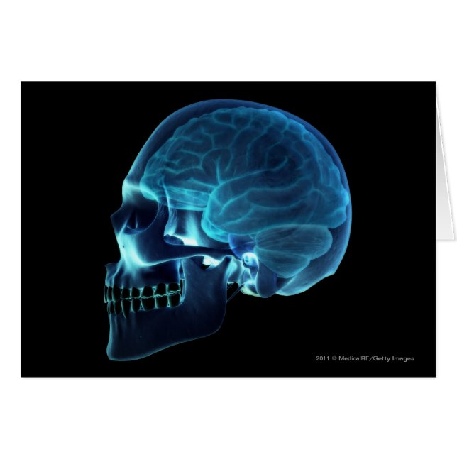 X-ray of the brain inside a skull (Front Horizontal)