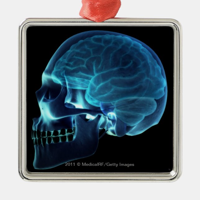 X-ray of the brain inside a skull metal tree decoration (Front)